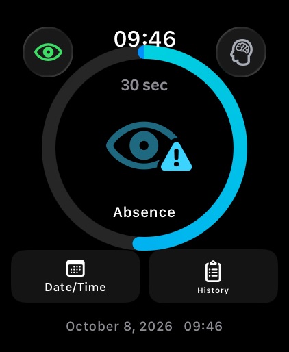 Apple Watch log screen: Absence seizure type with a 30 second duration ring and Awareness and Cognitive Impairment buttons